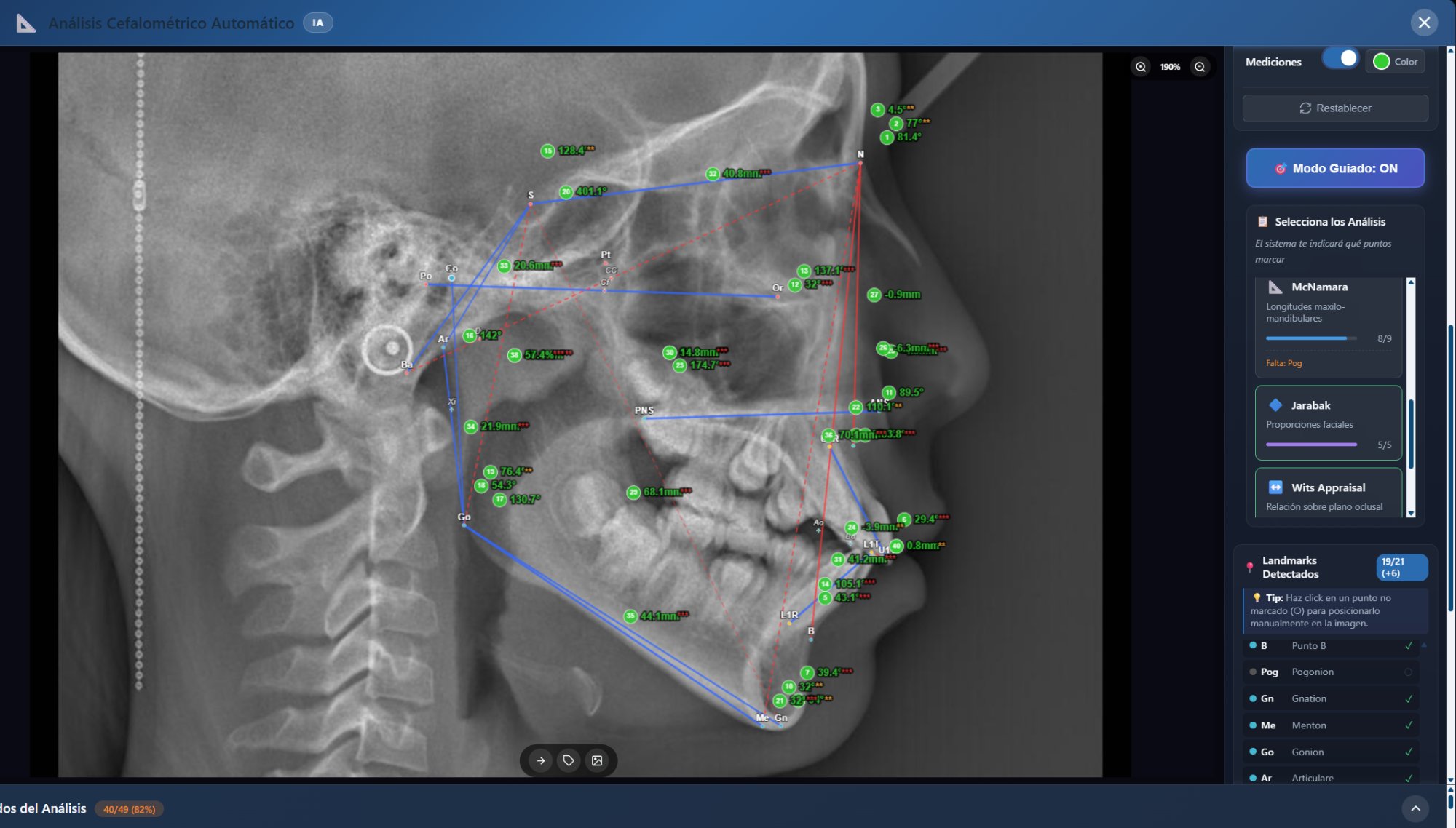 Herramienta de Apoyo Cefalométrico